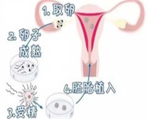 试管婴儿移植后几天才能知道结果？如何检测？