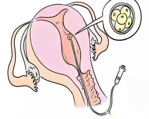 试管移植之后不能吃番茄是真的吗？