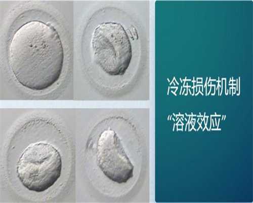 试管助孕排名-做完试管婴儿后多久能有胎心和胎芽